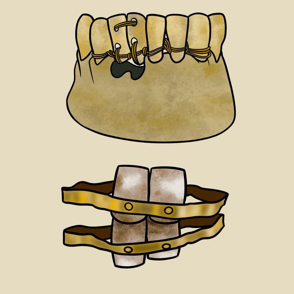 grillz