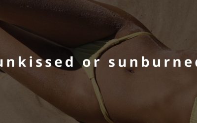 Sunkissed or sunburned?